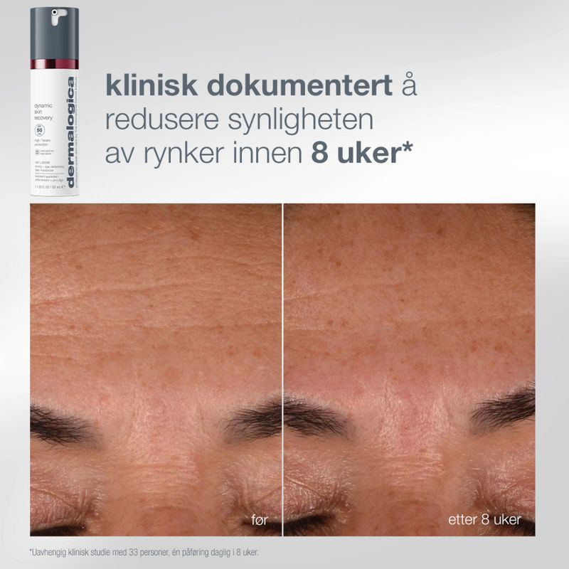 Dermalogica Expert Protect + Renew
